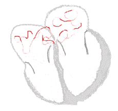 Heart_conduct_atrialfib