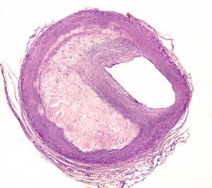 iwamatsu-allaire-fig-1